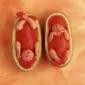 Фотографии детей Anne Geddes